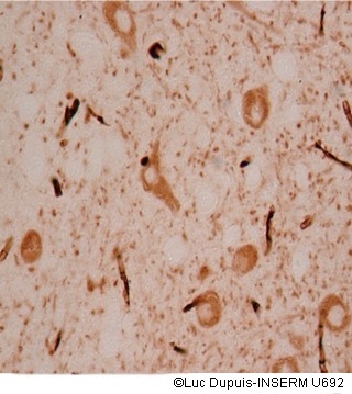 luc-dupuis-INSERMU-692