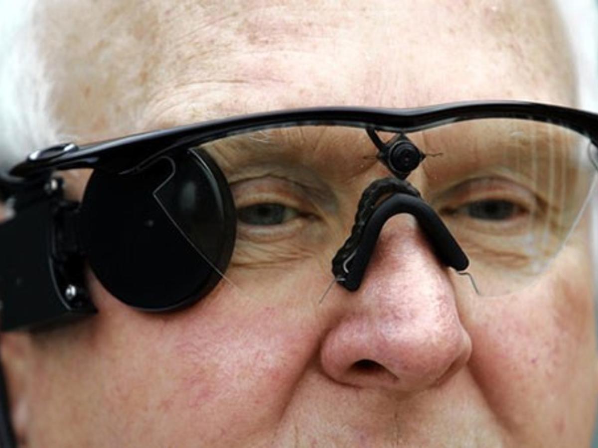 Oeil Bionique Argus II