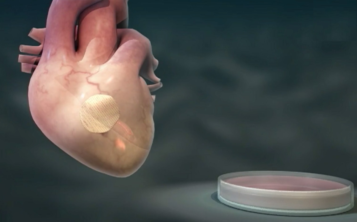 Patch coeur contant les cellules souches