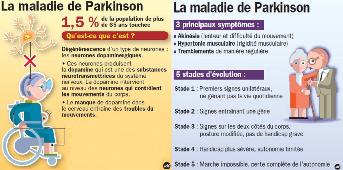 Journee mondial Parkinson graphique la maladie de Parkison