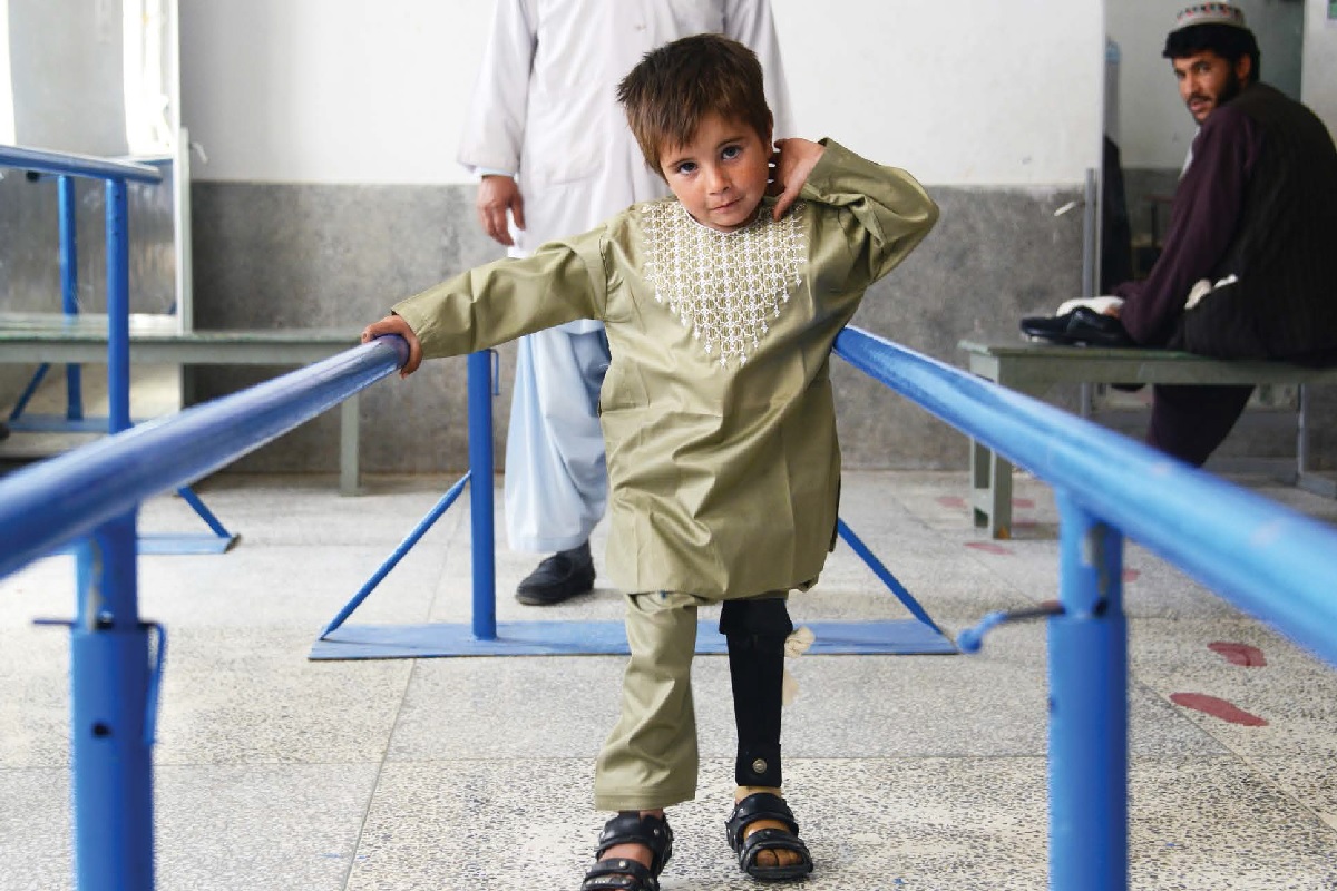 Un enfant ampute dans un des nombreux centre de reeducation de handicap international