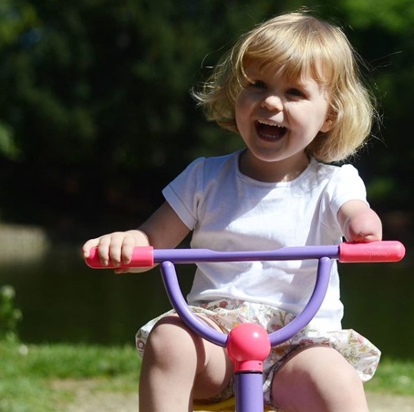 Victoire une petite fille nee avec une agenesie du bras gauche en juillet 2017 agee de trois ans aujourdhui