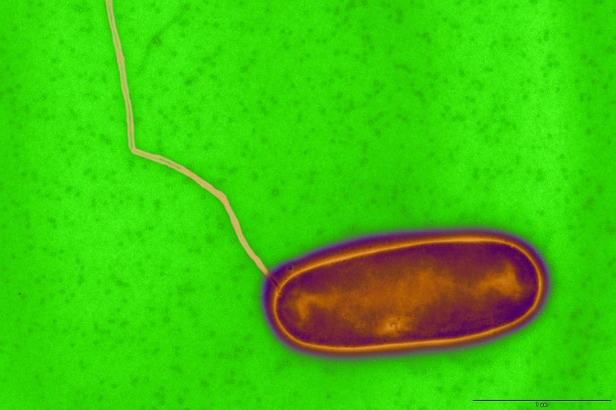 La légionellose causée par les bactéries legionella pneumophila