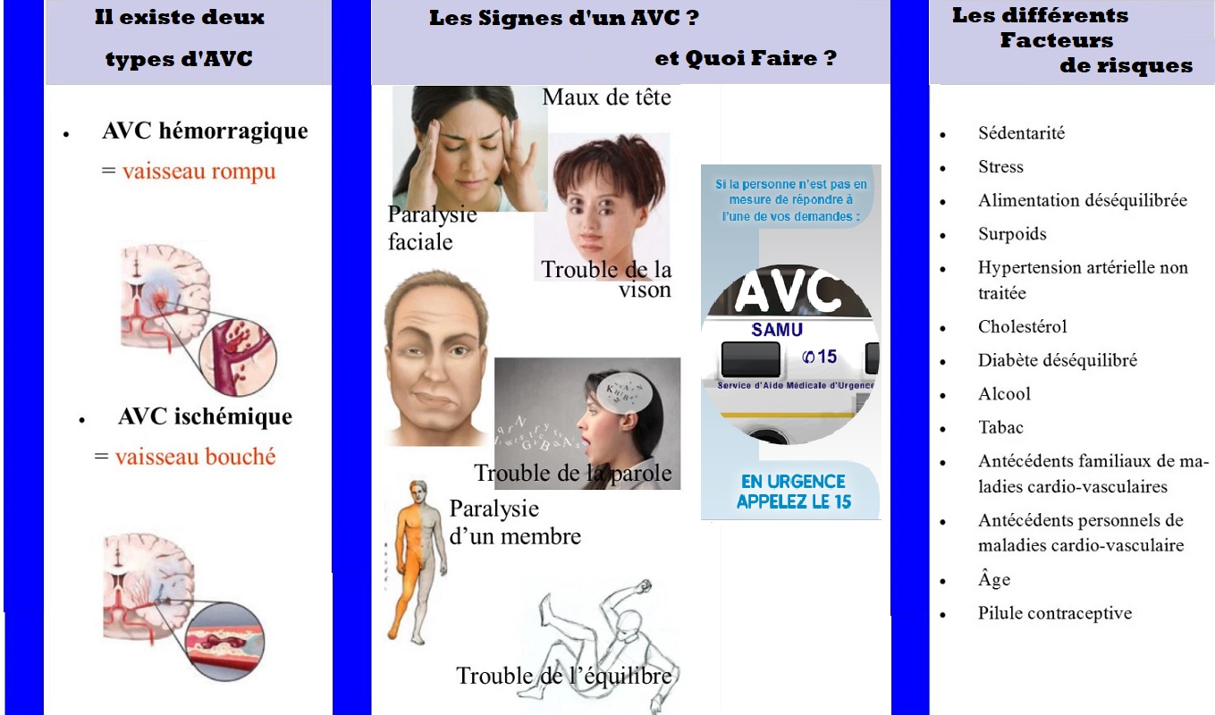 Types signes et facteurs de risques et quoi faire en cas de dAVC