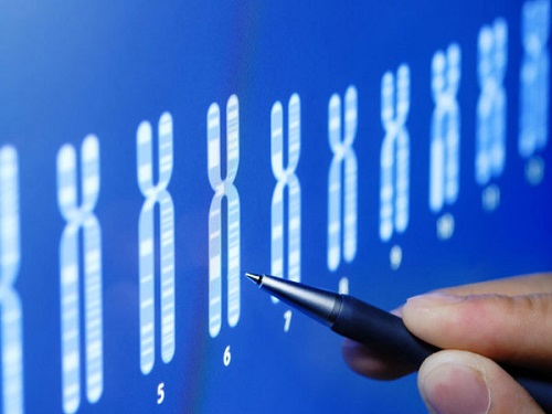 l'X fragile. Une maladie génétique rare et héréditaire prise en charge souvent trop tardivement.