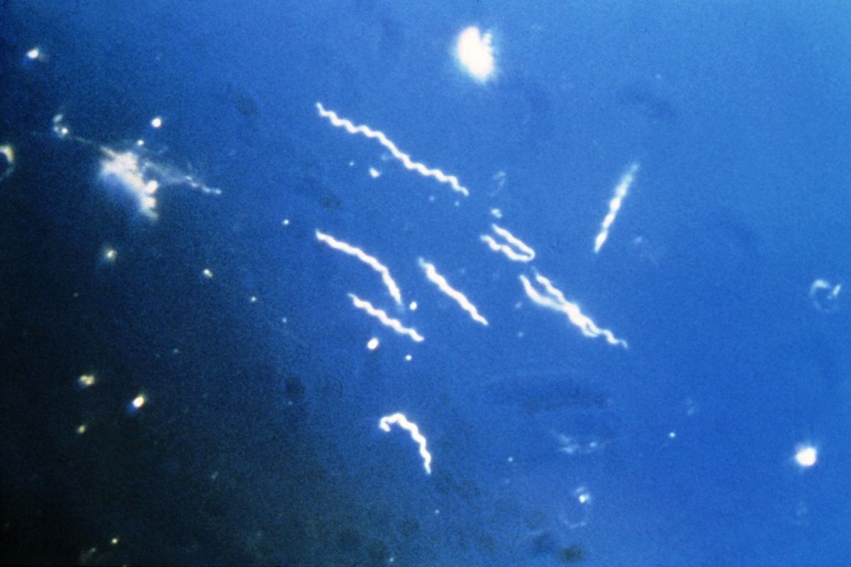 Agent pathogène responsable de la maladie Lyme grossie 400 au microscope électronique 2a7dc