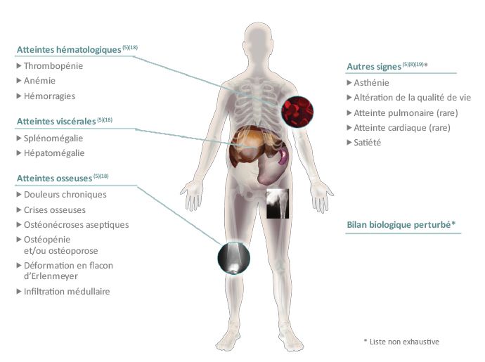 Page acceuil site maladie de gaucher