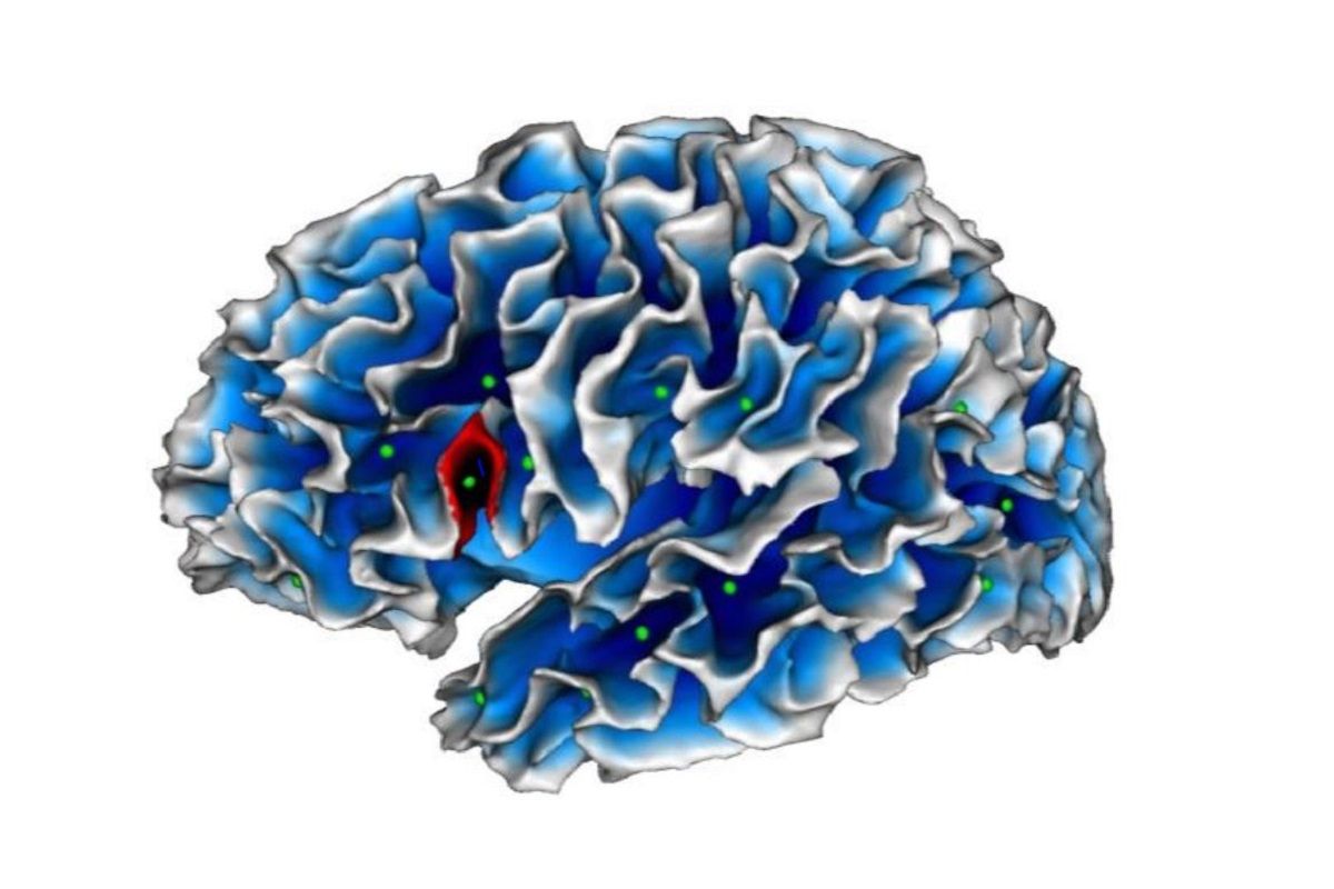 Matthieu un jeune autiste diagnostique en 2007