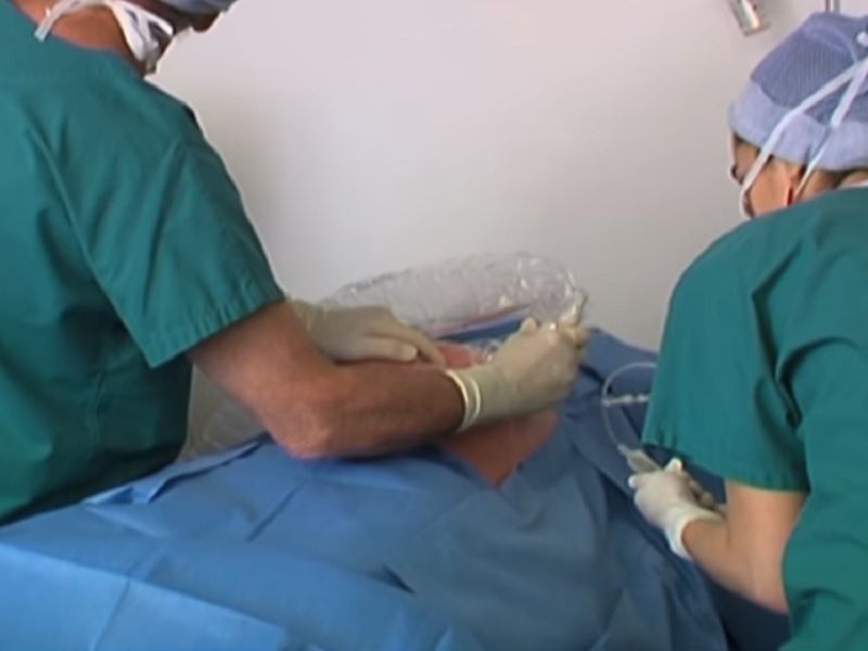 Realisation d une amniocentese a l hopital Robert Debre a Paris