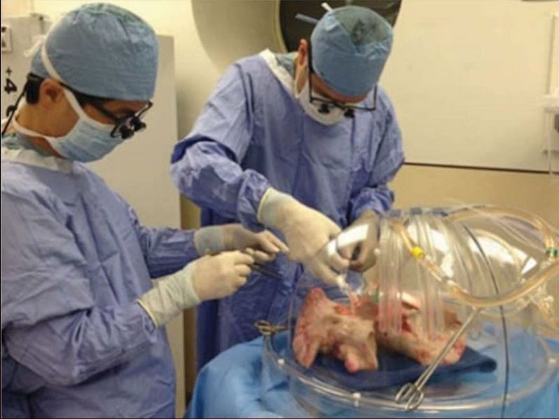 Une nouvelle technique de greffe la rehabilitation ex vivo du greffon