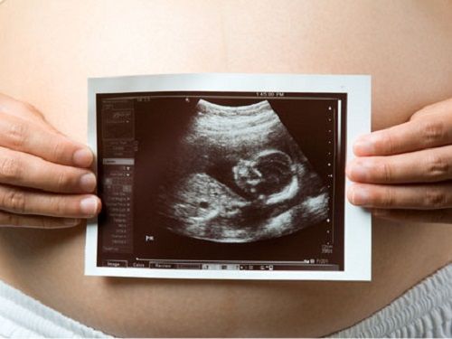 La gestion pour autrui realite anglaise