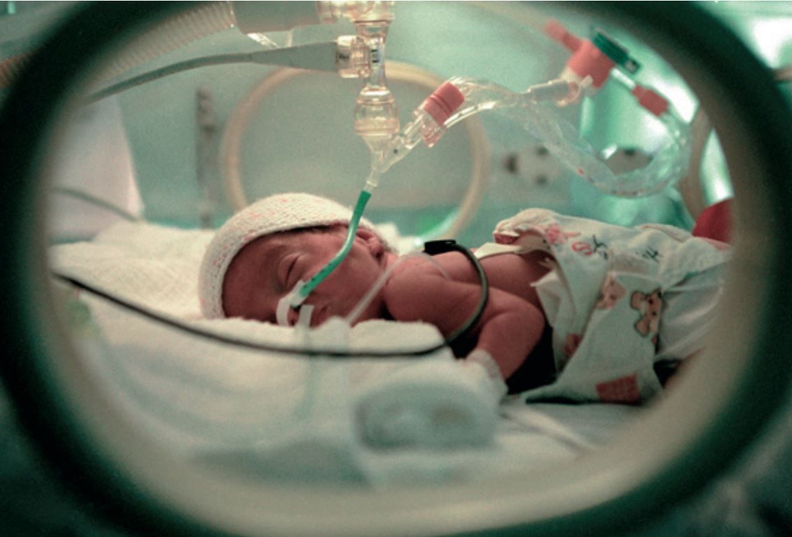 Enquete sur les prematures. Un enfant premature dans sa couveuse