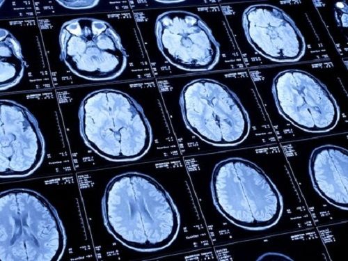 Une personne participe à une expérience sur le cerveau menée par le Centre de recherche en neurosciences à Lyon le 15 mars 2012 ©afp.com/Jean-Philippe KSIAZEK