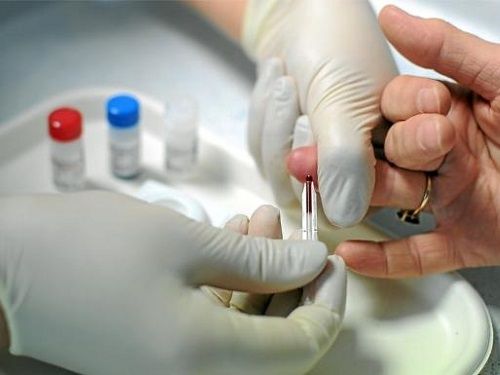 Simple et rapide d'utilisation, le Trod semble avoir fait désormais ses preuve et proposé en dehors des murs des structures médicale.
